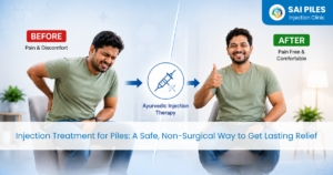 Non-surgical treatment for piles