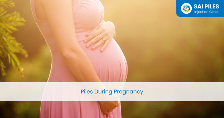 piles during pregnancy